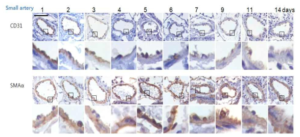 방사선 조사 후 2일째부터 CD31의 발현이 감소되고 5일이후로는 내피세포의 핵 돌출 및 사멸이 일어나서 혈관내피세포의 모양이 손상되는 것을 관찰함. 또한 혈관내피세포, 혈관벽, 혈관주위의 결합조직에서 αSMA의 발현이 증가됨
