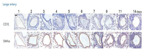 large artery에서 small artery와 같이 방사선 조사 후 혈과내피세포의 CD31의 발현이 감소하고 혈관벽의 αSMA의 발현이 증가하나 small artery에 비해 그 변화폭이 작음