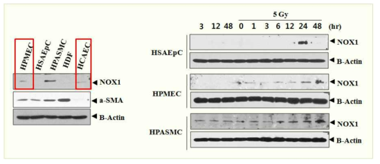 사람 폐혈관내피세포 (Human Pulomonary Microvascular Endothelial Cells; HPMEC), 사람 세폐포의 외피세포 (Human Small Airway Epithelial Cells; HSAEpC), 사람 폐동맥평활근세포 (Human Pulmonary Artery Smooth Muscle Cells; HPASMC), 사람 폐섬유세포 (Human Pulmonary Fibroblasts; HPF), 사람 관상동맥 혈관내피세포 (Human Coronary Artery Endothelial Cells; HCAEC)에서 NADPH oxidase 1 (NOX1)의 발현 정도를 관찰함. NADPH oxidase 1 (NOX1)은 사람 폐동맥평활근세포 (HPASMC)에서 가장 많이 발현되고 다음으로 사람 폐혈관내피세포 (HPMEC)와 사람 관상동맥 혈관내피세포 (HCACE)에서 발현되며, 사람 폐세포의 외피세포 (HPSAEpC)와 폐섬유세포 (HPF)에서는 발현을 관찰하기 어려움. 사람 폐세포의 외피세포 (HSAEpC), 사람 폐의 미세혈관내피세포 (HPMEC), 사람 폐동맥평활근세포 (HPASMC)에 방사선을 조사 (5 Gy)하고 NOX1의 발현이 증가하는 것을 관찰