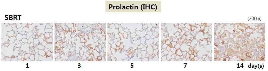 제 4 세부과제로부터 체부정위 방사선 조사 (SBRT; Stereotactic body radiation therapy, 90 Gy, 3 mm Collimator)를 받은 마우스의 폐 조직을 제공받아 면역 염색을 수행하여, 방사선에 의한 섬유화 과정 동안 prolactin의 발현 변화 (짙은 갈색)를 관찰. 폐 섬유화가 진행됨에 따라 모세혈관내피세포 및 대동맥 혈관내피세포 등 혈관내피세포에서 prolactin의 증가를 현저히 관찰할 수 있었음. 또한, prolatin이 분비 되는 형태로 염색됨을 확인 할 수 있었음