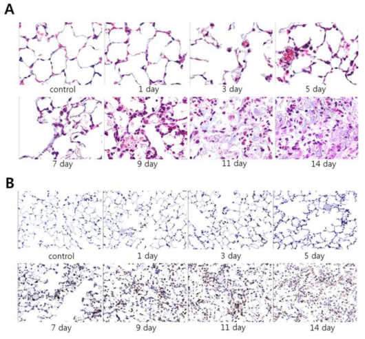 Evaluation of fibrosis