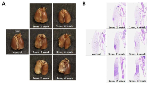 다양한 체적으로 방사선 조사 후 gross morphology와 H&E staining 결과