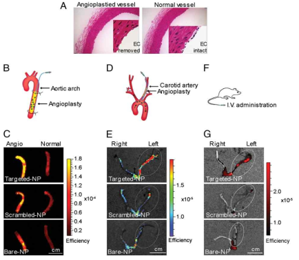 상처난 혈관의 혈관성형술에서의 nanoburr 효능 검정 A. 혈관의 endothelial cell을 제거하여서 인위적인 동맥경화 유도 B, C. ex vivo로 abdominal aorta injury model에서의 nanoburr 전달 효능 검정 D, E. in vivo로 nanoburr를 intraarterial로 투여하여 nanoburr 전달 효능 검정 F, G. in vivo로 nanoburr를 i.v 투여하여 nanoburr 전달 효능 검정