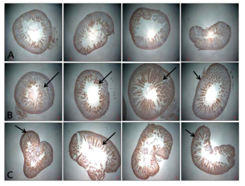 immunohistochemistry of tropomyosin in intestine of rat fed soy or cheonggukjang. 콩 (B)과 청국장 (C) 급여 쥐의 장점막의 microvili에 control (A) 쥐의 것보다 tropomyosin의 발현이 현저하게 증가하였다. 화살표는 tropomyosin의 발현이 특이적으로 많은 부분. 조직은 hematoxylin으로 counterstaining하였다