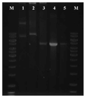 Restriction cut of pHYbpr86-1 from B. subtilis TFs. M, size marker; 1, pHYbpr86-1 plasmid; 2, pHYbpr86-1 BamHⅠ cut (9.67 kb); 3, pHYbpr86-1 BamHⅠand XbaⅠ cut(4.8 kb, 4.87 kb); 4, pHY300PLK BamⅠand XbaⅠ cut (4.87 kb); 5, bpr amplified (4.8 kb)