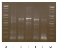 Gel electrophoresis of PCR products with degenerated primers for PR KS domain. M : 100 bp ladder; Lane 1, Fusarium. sp. (Group 1); Lane 2, Asp. oryzae (Group 2); Lane 3, Asp. fumigatus (Group 3); Lane 4, Arthrium. sp (Group 4); Lane 5, Asp. sydowii (Group 5)