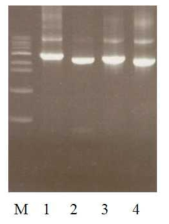 Gel electrophoresis of PCR products using primers for the exon of putative genes, β-glucosidase. Lane 1, ABG 7, 2895 bp; lane 2, ABG 9, 2601 bp; lane 3, ABG 13, 2571 bp; lane 4, ABG 30, 2295 bp