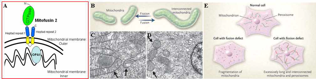 미토콘드리아와 연관된 발병기전. (A) MFN2 유전자 모식도, (B) 미토콘드리아의 융합기능에 장애가 발생하는 모식도, (C, D) 전자 현미경 사진, 및 (E) 관련 질병의 발생 모식도