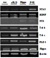 Expression of Neurotrophic factor and NT receptors in NPCs transfected with rPLD, hippocalcin or rPLD+hippocalcin