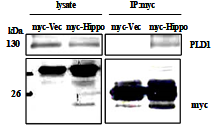 IP experiment after transfection of pCMV-myc-hippocalcin into H19-7 cells