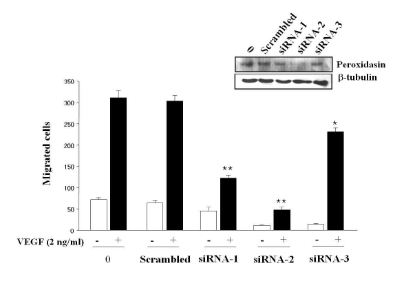 Peroxidasin knockdown에 따른 세포의 이동 효과