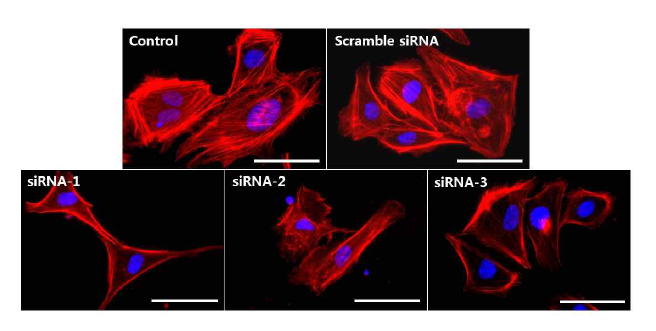 Peroxidasin knockdown에 따른 세포외 기질로의 부착 시 세포골격 배열