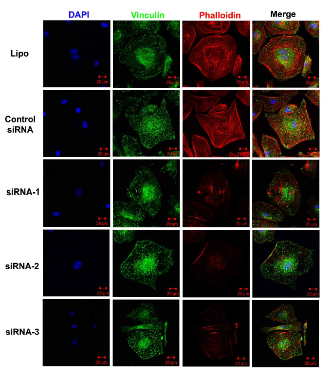 Peroxidasin knockdown에 따른 세포외 기질로의 부착 시 세포 골격 배열 및 focal adhesion complex formation