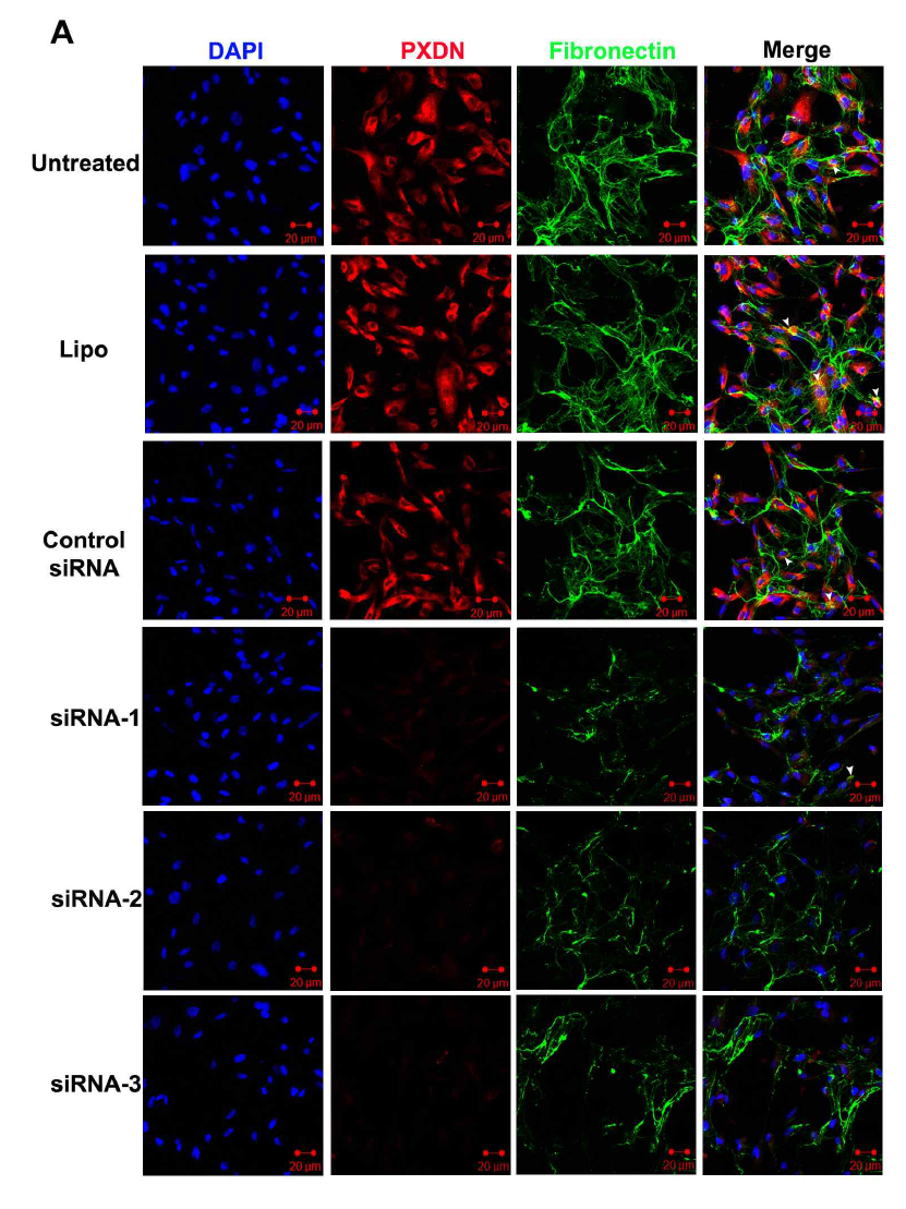 Peroxidasin knockdown에 따른 fibronectin deposition(fibril 형성) 변화