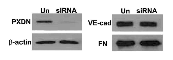 Peroxidasin knockdown 에 따른 VE-cadherin의 발현 양상 조사