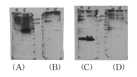Mouse의 항체를 이용한 IGcam 1-2 와 IGcam 3-4 단백질에 대한 Western blot. H: HUVEC; U: U87 (A) IGcam 3-4 injection한 mouse 1 (B) IGcam 3-4 injection한 mouse 2 (C) IGcam 3-4 injection한 mouse 3 (D) IGcam 1-2 injection한 mouse 3