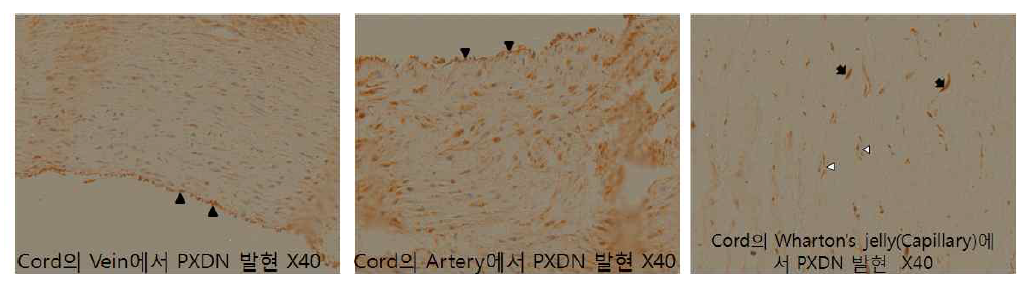 Human umbilical cord에 peroxidasin에 대한 면역조직화학염색 Arrow head는 peroxidasin이 발현되는 endothelium을 표시한 것이고, arrow는 Wharton’s jelly의 peroxidasin이 발현되는 MSC를, 흰색 arrow head는 Wharton’s jelly 내의 peroxidasin이 발현되는 모세혈관을 나타낸 것이다