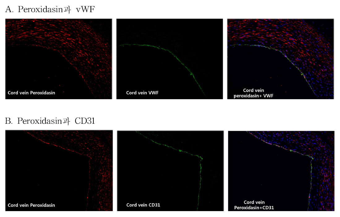 Human Umbilical Cord의 vein에서 peroxidasin과 vWF, CD31에 대한 면역조직화학염색