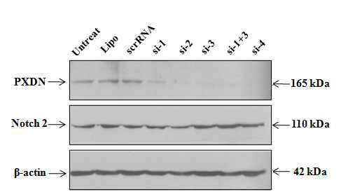 siRNA 처리에 의한 Peroxidasin, Notch 2 유전자 발현 변화 조사