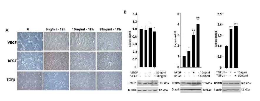 MSC에서 VEGF, bFGF, TGF-b1에 의한 PXDN 발현 조절