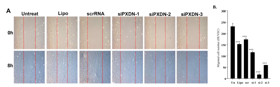 Wound-healing migration에서 PXDN의 knockdown 효과