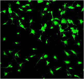 mouse primary cultured osteoblast의 TRPA1 immunostaining. Alexa Fluor 488 dye-conjugated 2ndary antibody로 visualization