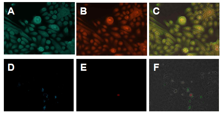 NHEK cell (A-C)과 PAM212 cell line (D-F) 의 TRPV3/cytokeratin 10 double immunostaining. Green: TRPV3, red: cytokeratin 10으로 표기. NHEK cell에서 풍부한 TRPV3 발현이 확인됨. C와 F는 각각 A+B, D+E를 merge한 결과