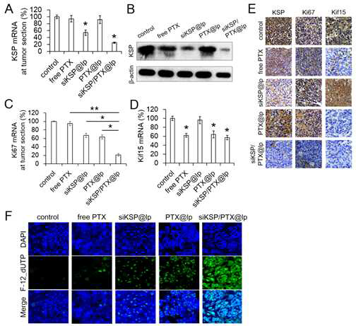 Investigation of KSP, Ki67, and Kif15 expression in the tumor tissues excised from the injected mice. (A, B) KSP mRNA and KSP protein levels in the excised tumor tissues were analyzed by qRT-PCR and western blotting. Each tumor samples were excised from mouse groups 26 days after the first injection. (C, D) Ki67 mRNA (cell proliferation marker) and Kif15 mRNA levels in the excised HeyA8-MDR tumor tissues were analyzed by qRT-PCR. (E) Immunohistochemical staining of paraffin-embedded tumor sections from the injected mice using anti-KSP, anti-Ki67, and anti-Kif15 antibodies. (F) TUNEL assay of tumor sections using a confocal microscope. Fluorescein-12-dUTP and DAPI were used to stain DNA strand breaks and nuclei, respectively
