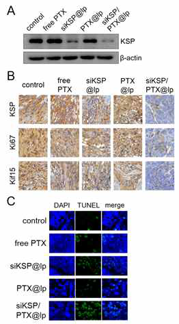 Investigation of marker gene expression (KSP, Ki67, and Kif15) and apoptosis in the tumor tissues excised from the injected PDX model groups. (A) KSP protein levels in the excised tumor tissues were analyzed by western blotting. (B) Immunohistochemical staining of paraffin-embedded tumor sections from the injected PDX model groups using anti-KSP, anti-Ki67, and anti-Kif15 antibodies. (C) TUNEL assay of tumor sections from the injected PDX model groups using a confocal microscope