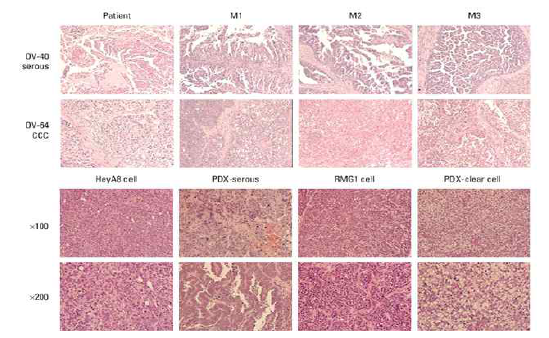 PDX 종양 조직과 암환자 종양조직의 병리 조직학적 유사성 규명