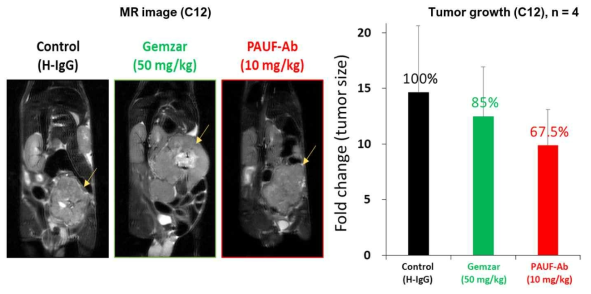 췌장암환자유래 종양 동소 이종 이식 모델에서 PBP1510의 종양 성장 억제 효능 (Case 12)