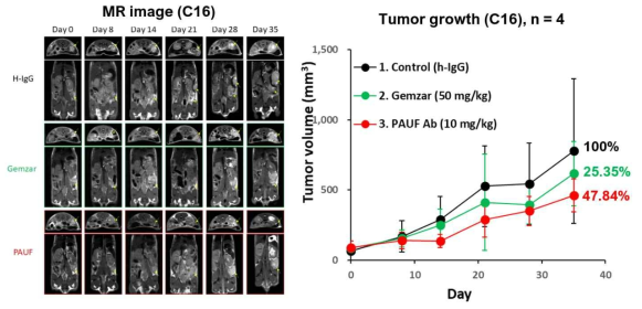 췌장암환자유래 종양 동소 이종 이식 모델에서 PBP1510의 종양 성장 억제 효능 (Case 16)