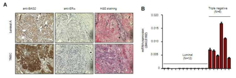 국내 유방암 환자 조직에서 BAG2 유전자 및 단백질 발현 분석