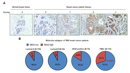 국내 유방암 환자 TMA 조직에서 유방암 아형에 따른 BAG2 단백질 발현의 임상병리학적 인과관계 분석