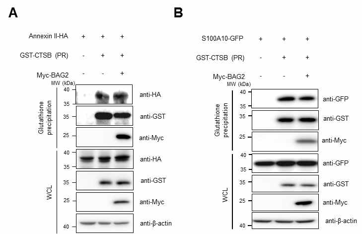 Pro-Cathepsin B의 propeptide region과 BAG2, Annexin II, 그리고 S100A10 단백질들 간의 상호 결합 분석