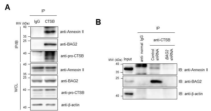 BAG2 단백질 발현에 따른 endogenous pro-Cathepsin B와 annexin II 복합체간의 상호결합 분석