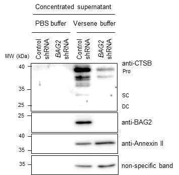 칼슘 의존적으로 세포막 표면에 존재하는 pro-Cathepsin B/Annexin II/BAG2 단백질 복합체 분석