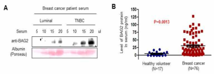 유방암 환자의 혈청 내에서 BAG2 단백질 분비 분석
