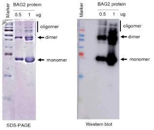 BAG2 sandwich ELISA 키트를 위한 BAG2 standard 단백질 정제 및 확인