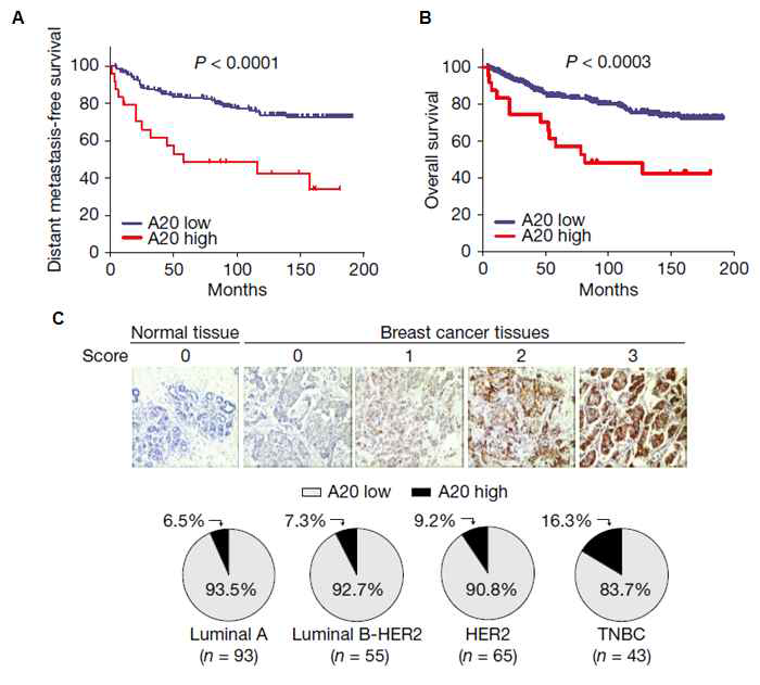 국내 유방암 환자의 TMA을 이용한 A20 단백질 발현에 따른 환자 생존율 분석과 유방암 아형에 따른 A20 발현이 높은 환자의 비율 분석
