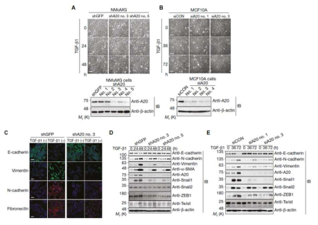 A20 knockdown 세포주를 이용한 TGF-β 매개 EMT에서 A20의 역할 분석