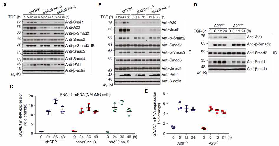 A20 유전자 발현 저하에 따른 Smad 및 Snail1 단백질 발현 및 Snail1 mRNA 수준 분석