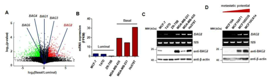 유방암 아형에 따른 co-chaperone BAG2 유전자와 단백질 발현 분석