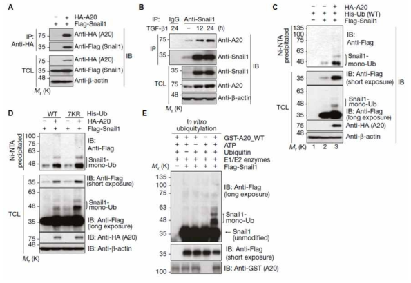 A20 단백질에 의한 Snail1의 다중모노유비퀴틴화