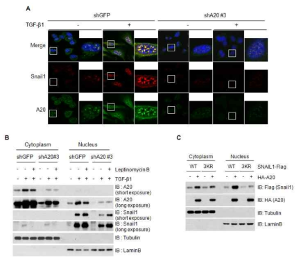 A20 단백질에 의한 Snail1 단백질의 안정화가 일어나는 세포내 위치 분석