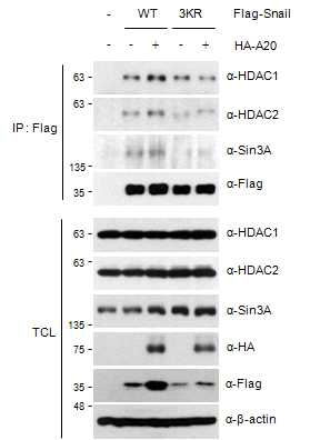 A20 단백질에 의한 Snail1 단백질과 co-repressor 단백질간 interaction 분석