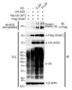 탈유비퀴틴화 효소 저해제 처리에 따른 Snail1 모노유비퀴틴화 수준과 단백질 안정성 분석