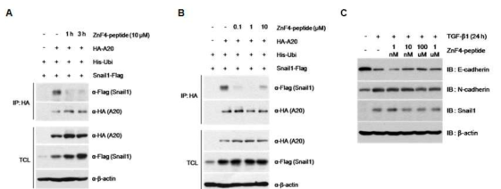 A20 단백질의 ZnF4-peptide를 이용한 A20-Snail1 상호작용 억제제의 효과 검증