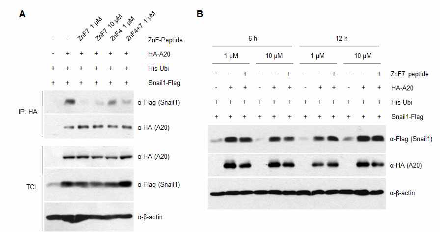 ZnF7 펩타이드의 A20-Snail1 상호작용 및 Snail1 단백질 안정성 저해 효과 확인