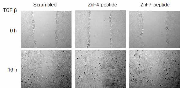 ZnF4 및 ZnF7 펩타이드의 Wound healing assay에 미치는 효과 분석